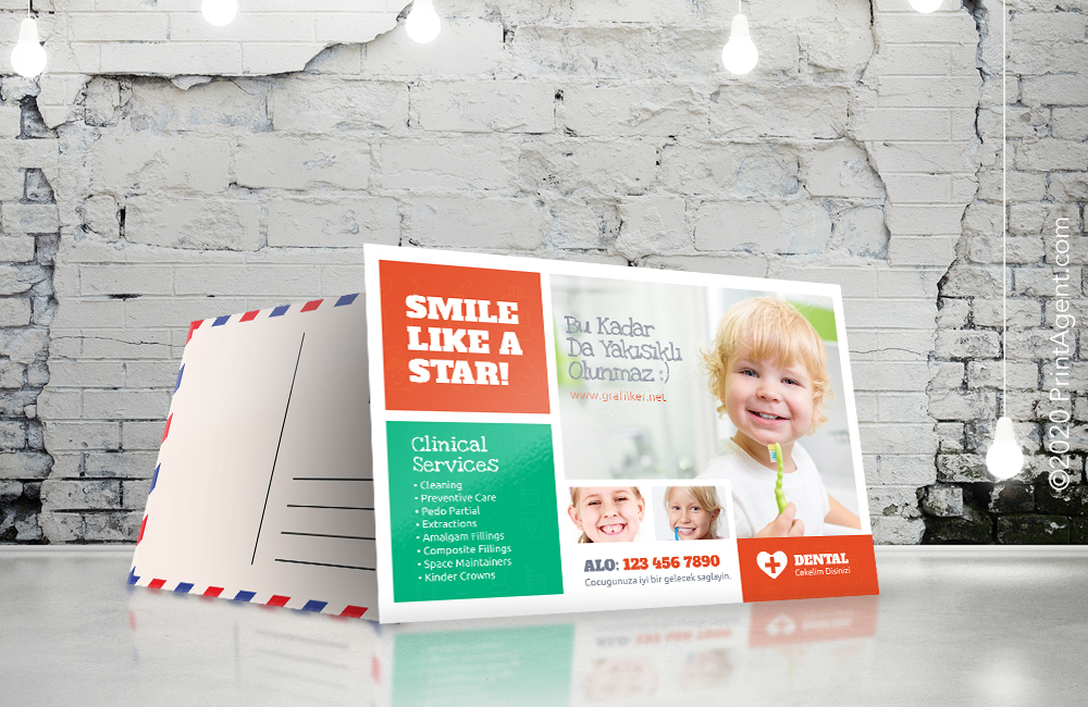 High Gloss Coating Double Sided